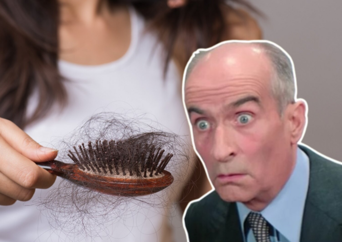 Выпадение волос (Hair loss)